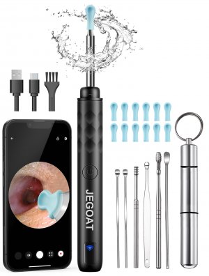 Ear Wax Removal Tool Camera, Ear Cleaner with Camera, 1296P HD Ear Scope, 6 LED Lights and 12 Ear Picks, Earwax Removal with Otoscope, Jet Black